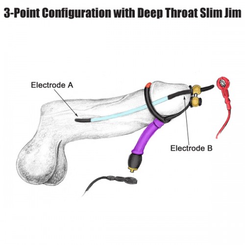 throat electrode Deep
